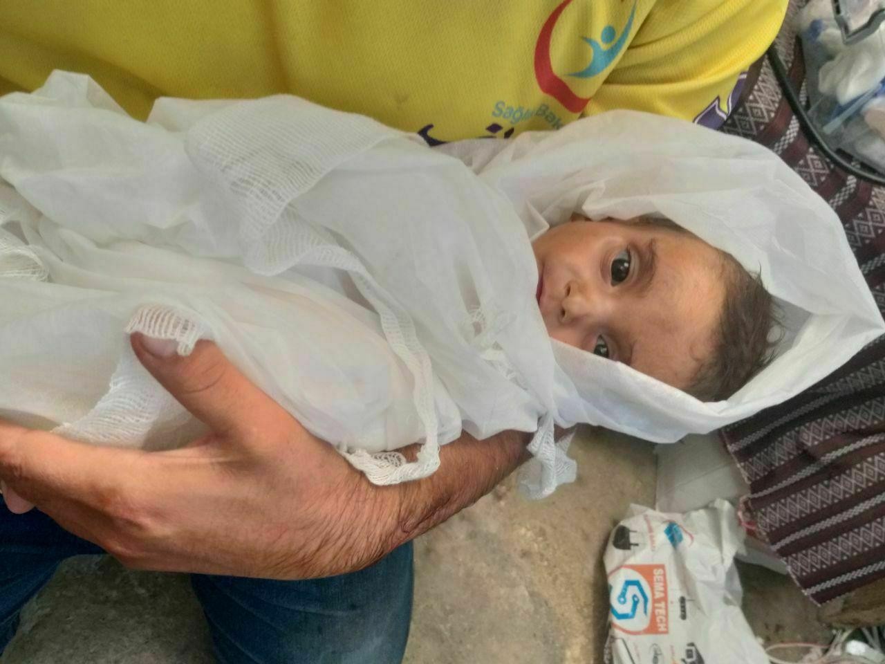 وفاة طفلة رضيعة بسبب الجوع شما...