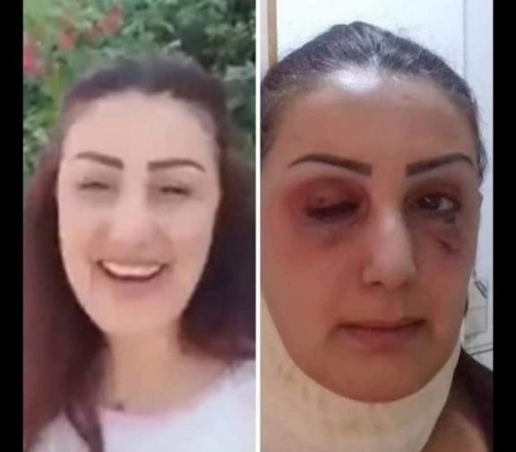 بعد انتشار فيديو لها.. صفحات ت...