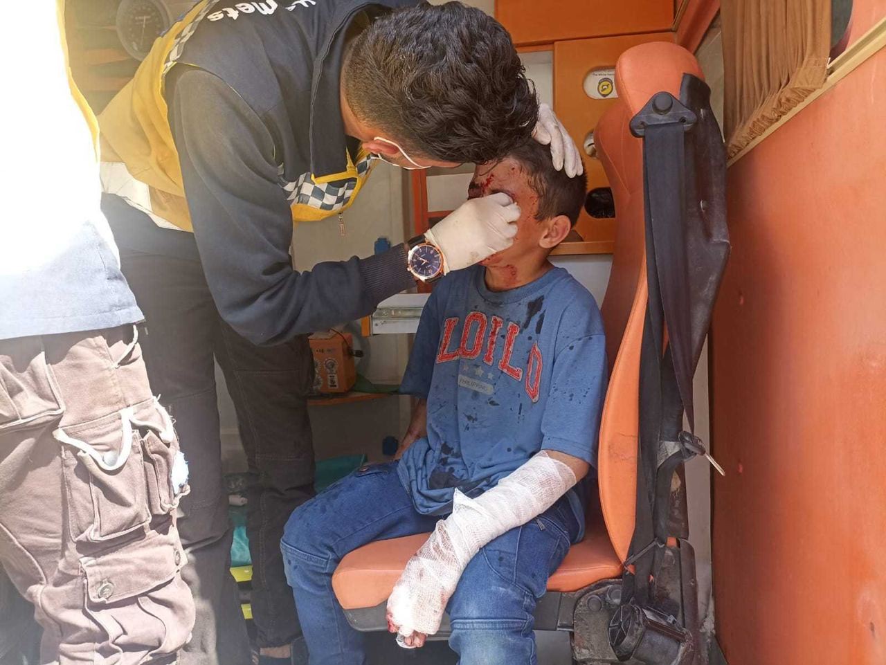 إصابة امرأة وطفليها بانفجار مخ...