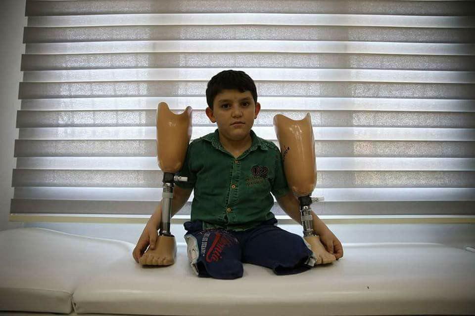 طفل "بابا شيلني" يحصل على ساقي...