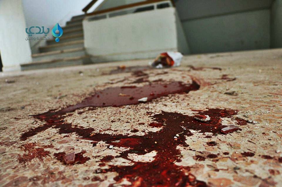 نصفهم أطفال ونساء.. سوريا ودعت...