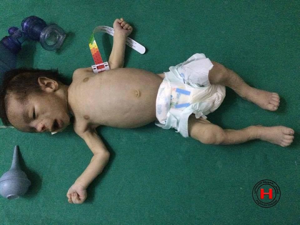 1500 حالة مرضية مزمنة تنتظر ال...