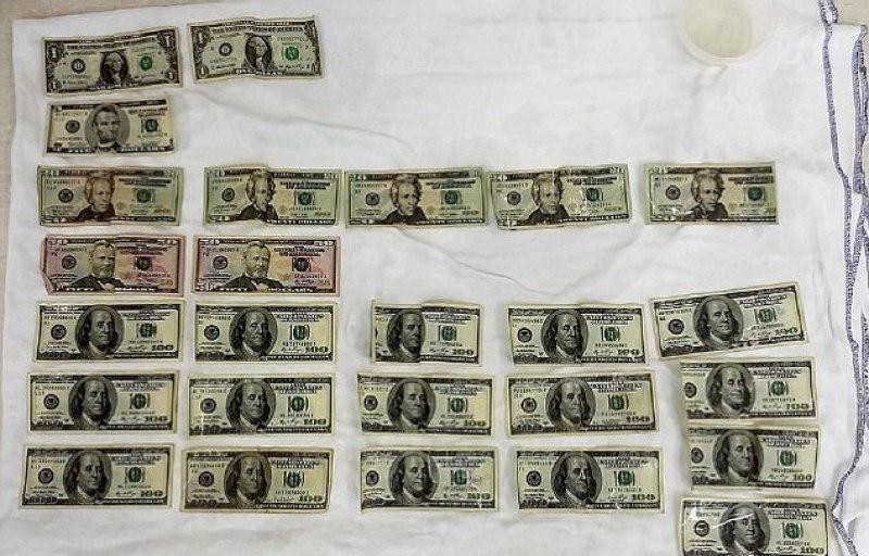 أطباء يعثرون على 1800 دولار دا...